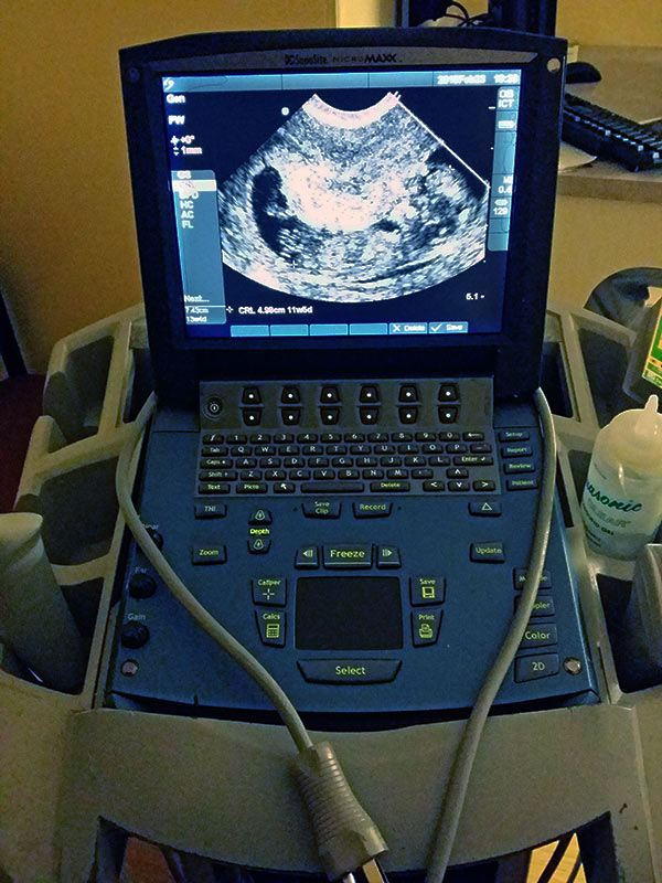 ultrasound-machine